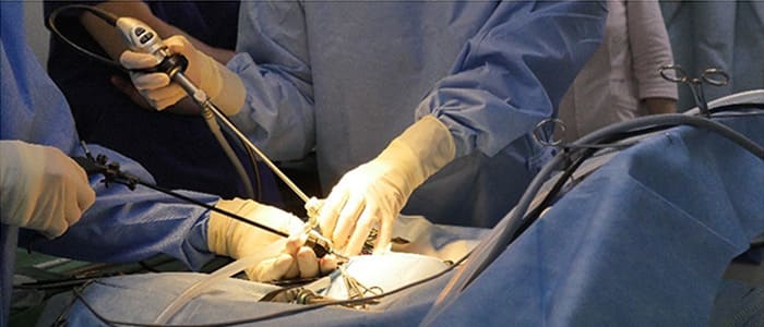 腹腔鏡手術について